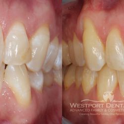 Westport Dental