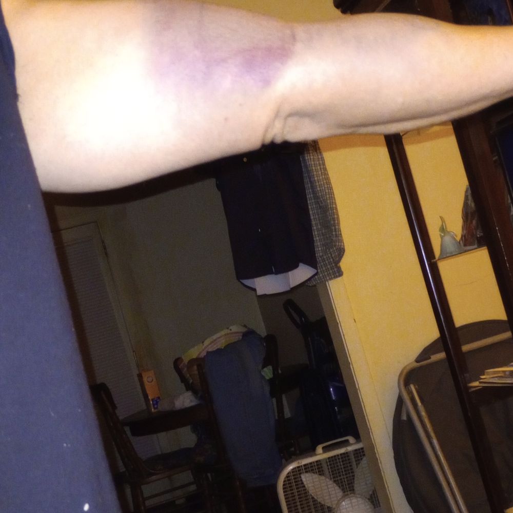 Biolife Plasma Services Bossier City, LA - Last Updated December 2025 - Yelp, image size:1000x1000