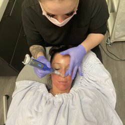 Skin By kaitlyn - Microneedling! Also known as the vampire facial This treatment is good for fine lines and wrinkles, acne scars, texture, and large pores.