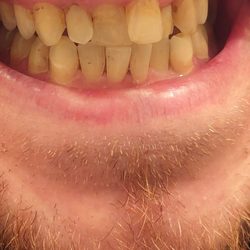 Grayslake Dentistry