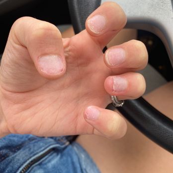 Cedar Nail Spa - Very painful acrylic removal. - Nail Salons Near Me - Groton, Connecticut Cedar Nail Spa - Very painful acrylic removal. - Nail Salons Near Me - Groton, Connecticut