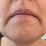 Photo of Elizabeth King Electrolysis