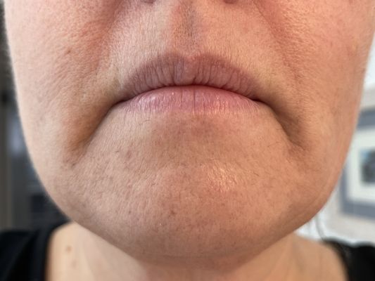 Electrolysis - Elizabeth King has been providing electrolysis to clients in the Los Altos area for over 30 years. She works with each client to ensure effective treatment. Elizabeth’s hair removal treatment uses both blend and short wave electrolysis methods for lasting results. Electrolysis - Elizabeth King has been providing electrolysis to clients in the Los Altos area for over 30 years. She works with each client to ensure effective treatment. Elizabeth’s hair removal treatment uses both blend and short wave electrolysis methods for lasting results.