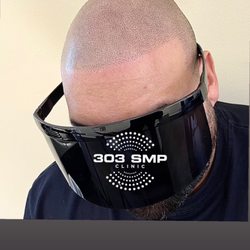 303 SMP Clinic - Buzz cut look natural hairline