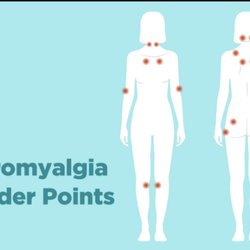 Gavrilyuk Oleg, MD - Fibromyalgia treatment