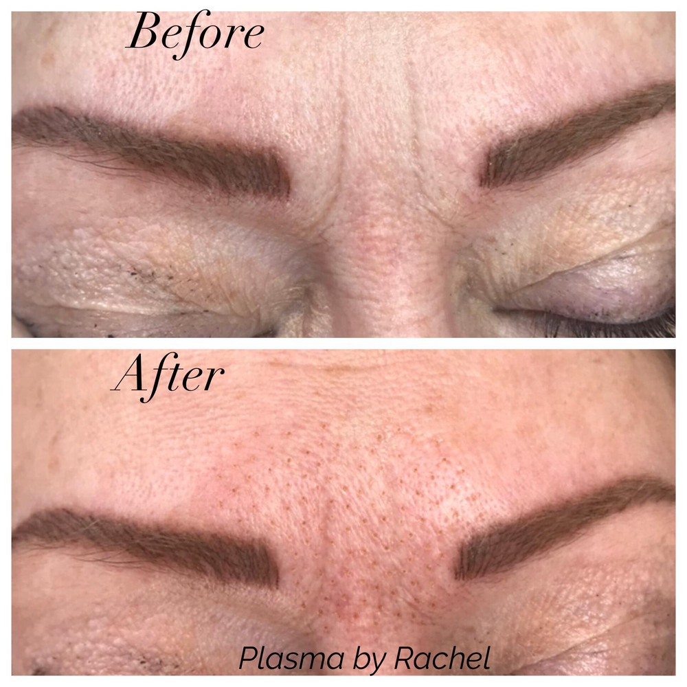 ELITE PERMANENT MAKEUP & AESTHETICS 57 Highfield Road, Corfe Mullen