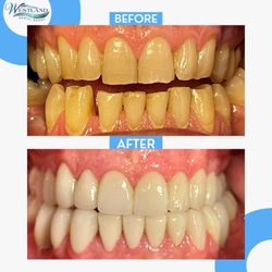 Westland Dental Group - Full Mouth Rehabilitation