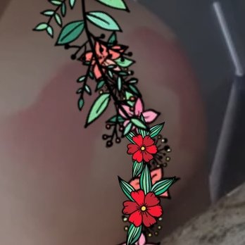 Beleza Surgery - There were hard painful lumps in my cheeks. Some came to the surface and broke through my skin. Others went away w/meds. - Medical Spas Near Me - Cedar Park, Texas