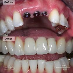 Montclair Smile Design