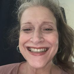 A-1 Family Dental Care - After getting my first two root canals on both upper canines and cleaning, x-rays, etc. I'm pleased to hear my teeth are able to be saved.