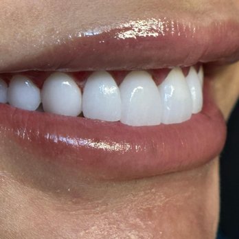 My Smile Center - General Dentistry Near Me - Miami, Florida My Smile Center - General Dentistry Near Me - Miami, Florida