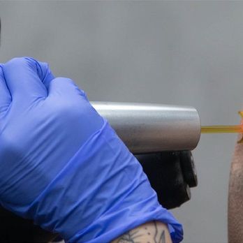 Removery Tattoo Removal & Fading - Tattoo Removal Near Me - Albany, New York Removery Tattoo Removal & Fading - Tattoo Removal Near Me - Albany, New York