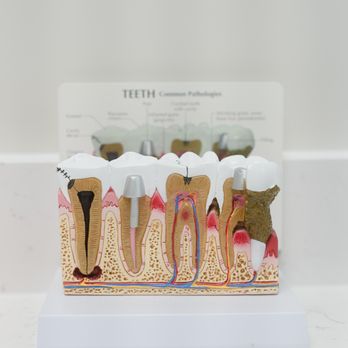 Clear Smiles Dental - General Dentistry Near Me - Margate, Florida
