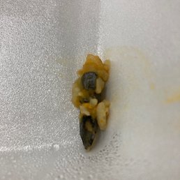 Screw driver piece in my wet burrito Screw driver piece in my wet burrito