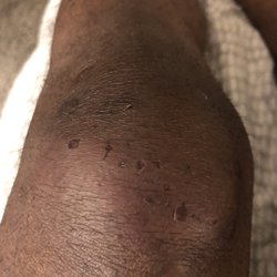 Torrance Police Department - Officer Villegas repeatedly slammed my knees to the ground displacing my knee cap! TPD Kissinger and Montreal are responsible too