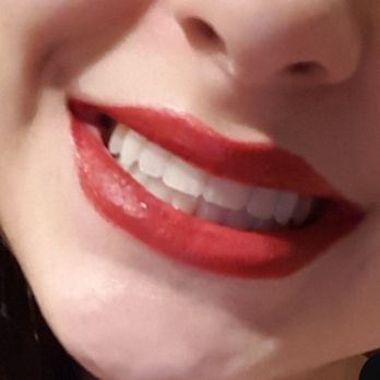 Sun Orthodontist Braces & Invisalign - The grand finale - Orthodontists Near Me - Hialeah, Florida Sun Orthodontist Braces & Invisalign - The grand finale - Orthodontists Near Me - Hialeah, Florida