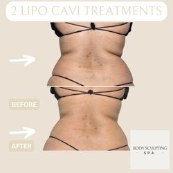 Body Sculpting Academy