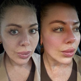 Face Bliss - Massage Near Me - Los Angeles, California