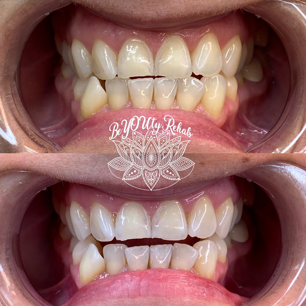 BeYOUty Rehab Microblading  Logo