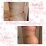 Photo of Body Sculpting By Daisy