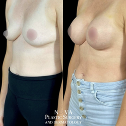 NOVA Plastic Surgery and Dermatology