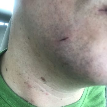 Lu's Shave 'N Cuts Barber Shop - They cut my face open when I went in for a simple shave. Watch out! - Barbers Near Me - Tomball, Texas Lu's Shave 'N Cuts Barber Shop - They cut my face open when I went in for a simple shave. Watch out! - Barbers Near Me - Tomball, Texas