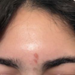 BotoxRN and MedSpa