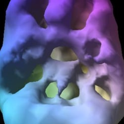 Amen Clinics - The effects of marijuana on the brain.