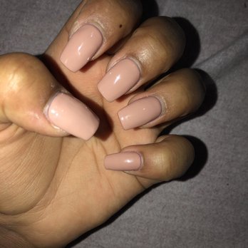 Max Nails - You can see the bumpiness on the them and how thick the nails look - Waxing Near Me - Lake Oswego, Oregon