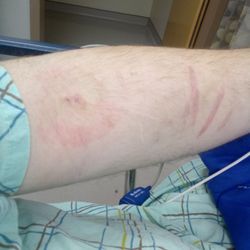 Hoboken University Medical Center - They stuck me twice and gave up no blood work at all