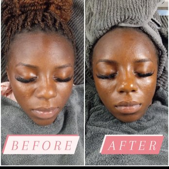 Relax And Restore - Facial - Massage Therapy Near Me - Rochester, New York Relax And Restore - Facial - Massage Therapy Near Me - Rochester, New York