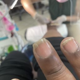 Uneven nails