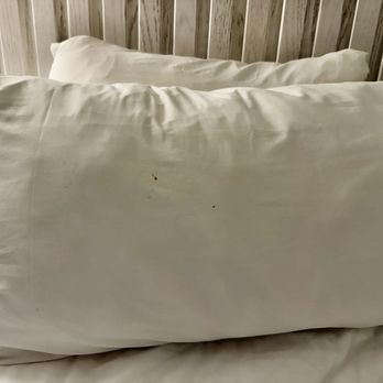 Ocean Place Resort & Spa - old blood stain on pillowcase - Day Spas Near Me - Long Branch, New Jersey Ocean Place Resort & Spa - old blood stain on pillowcase - Day Spas Near Me - Long Branch, New Jersey