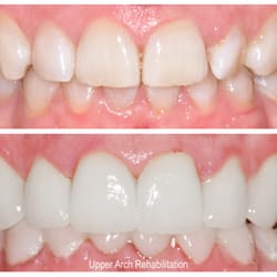 David de Jongh, DDS - Upper arch rehabilitation