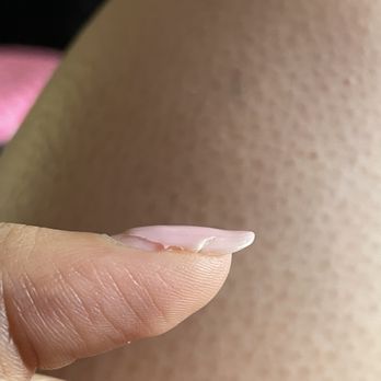 Casabella Salon - My nail is literally curved up! - Nail Salons Near Me - Washington, DC, District of Columbia