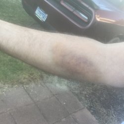TPMG Imaging and Breast Center - 3 days later