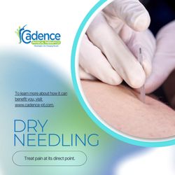 Cadence Physical Therapy - We Offer Dry Needling. 

Visit us and try this  service.
