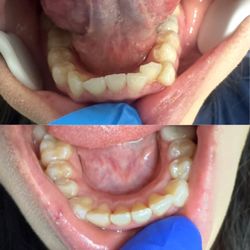 West Covina Perfect Smile Dentistry