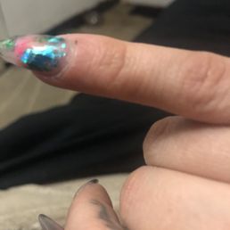 Cut on my pinky Cut on my pinky