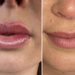 Med Ink Artistry - Lip Blushing