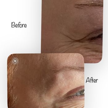 Vibrant 11 Aesthetics - Medical Spas Near Me - Shelton, Washington Vibrant 11 Aesthetics - Medical Spas Near Me - Shelton, Washington