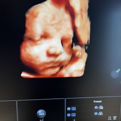 Baby Waves Imaging - 4D ultrasound at 27 weeks
