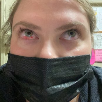 The Lash Bar South Shore - Eye infection - Eyelash Service Near Me - Norwell, Massachusetts