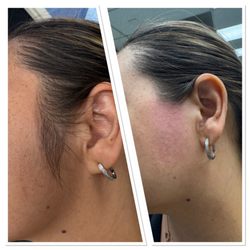 Perfect Threading - Sideburns threading