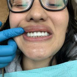 Lotus Dental Group - After