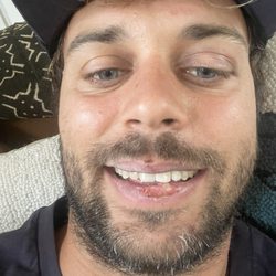 Pablo Liciaga, DDS - After dr Pablo.