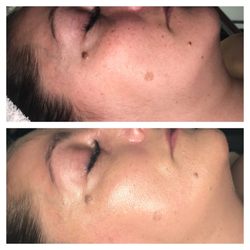 Sundance Face Spa - Dermaplaning with makeup add on