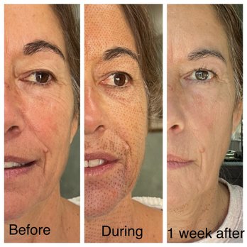 Legacy 41 - Skin Care Near Me - Sea Girt, New Jersey Legacy 41 - Skin Care Near Me - Sea Girt, New Jersey