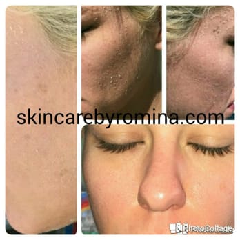 Romina J - AllCitySkin - Skin Care Near Me Romina J - AllCitySkin - Skin Care Near Me