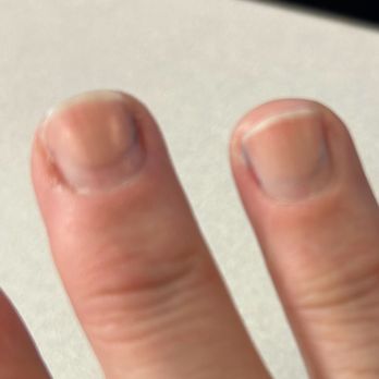 Blue Diamond Nails Spa - Grooved nail - Nail Salons Near Me - Enterprise, Nevada Blue Diamond Nails Spa - Grooved nail - Nail Salons Near Me - Enterprise, Nevada